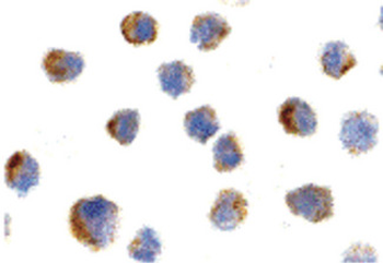 NGFR/CD271/TNR16 Antibody