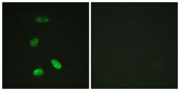 MYB/c-Myb Antibody