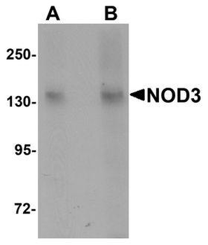 NOD3/NLRC3 Antibody