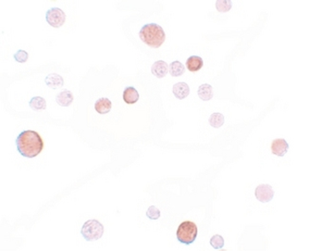 PLAC1 Antibody