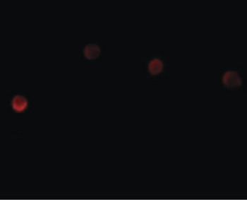 PLAC1 Antibody