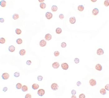 PAPPA2/Pappalysin 2 Antibody