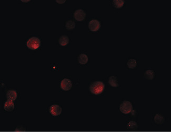 PAPPA2/Pappalysin 2 Antibody