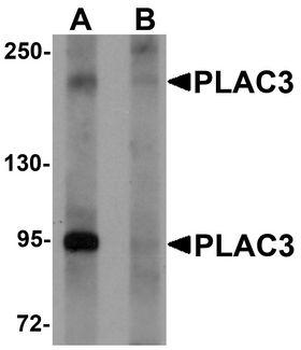 PAPPA2/Pappalysin 2 Antibody