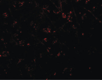 SYNPO/Synaptopodin Antibody