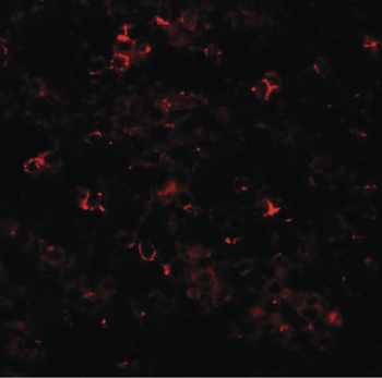 SLC39A10/ZIP10 Antibody