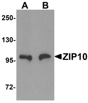 SLC39A10/ZIP10 Antibody