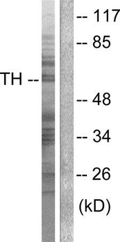 TH/Tyrosine Hydroxylase Antibody