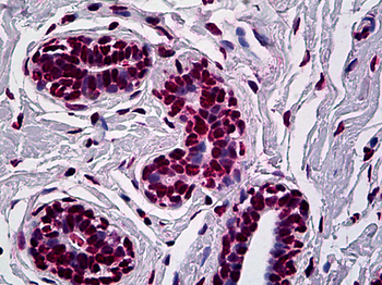 AML1/RUNX1 Antibody