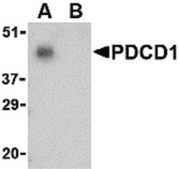 PDCD1/CD279/PD-1 Antibody