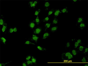 GAX/MEOX2 Antibody