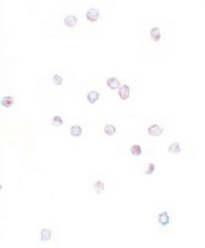 CD225/IFITM1 Antibody