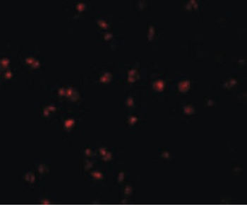 CD225/IFITM1 Antibody
