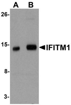CD225/IFITM1 Antibody