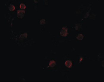 FREM1 Antibody
