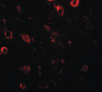 CIITA Antibody
