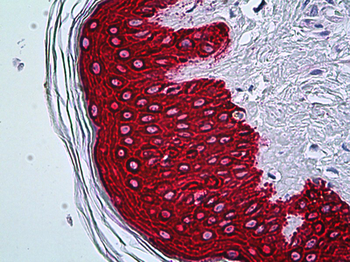 KRT5/CK5/Cytokeratin 5 Antibody