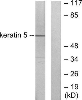 KRT5/CK5/Cytokeratin 5 Antibody
