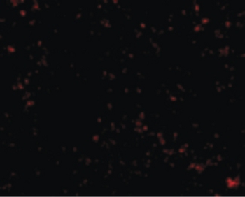 SKIL/SNO/SnoN Antibody