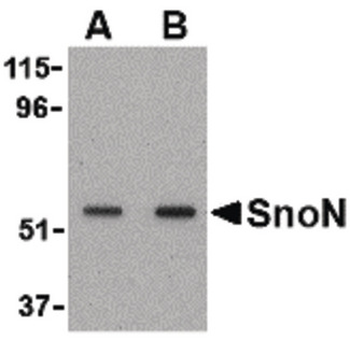 SKIL/SNO/SnoN Antibody