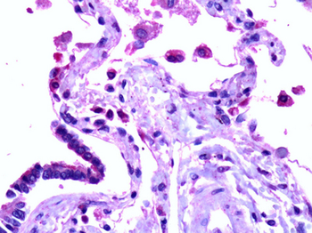 SFTPD/Surfactant Protein D Antibody