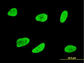 SGK1/SGK Antibody