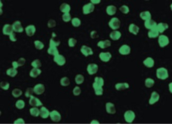 DAPK3/ZIP Kinase Antibody