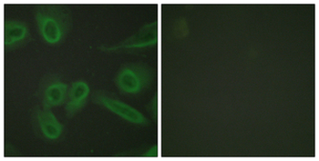 PECAM-1/CD31 Antibody
