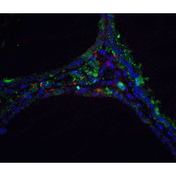 DNASE2/DNase II Antibody