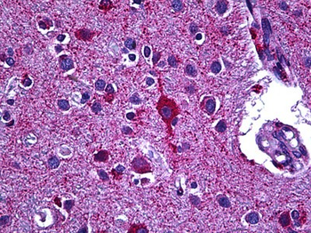 GAD/Glutamate Decarboxylase Antibody