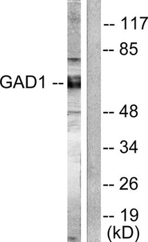 GAD/Glutamate Decarboxylase Antibody