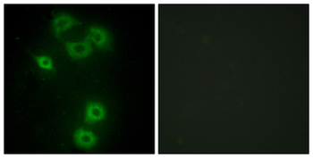 ETK/BMX Antibody
