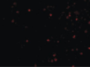 IKBKAP/IKAP Antibody