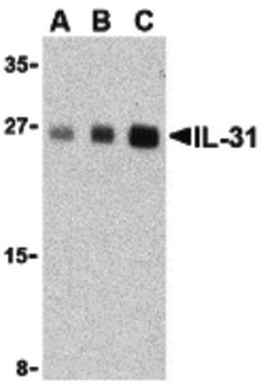 IL31 Antibody
