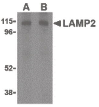 LAMP2/CD107b Antibody