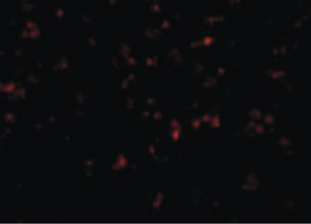 NALP1/NLRP1 Antibody