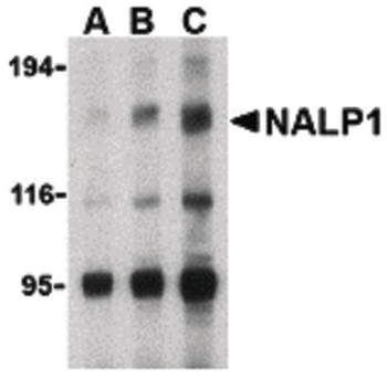 NALP1/NLRP1 Antibody