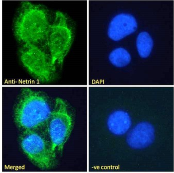 NTN1/Netrin 1 Antibody