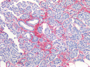 COL1A1/Collagen I Alpha 1 Antibody