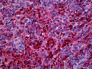 XCL1/Lymphotactin Antibody
