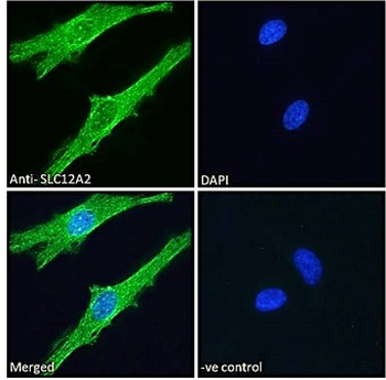 SLC12A2/NKCC1 Antibody