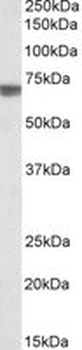 TGFBI Antibody
