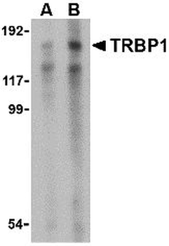 TRM3/TARBP1 Antibody