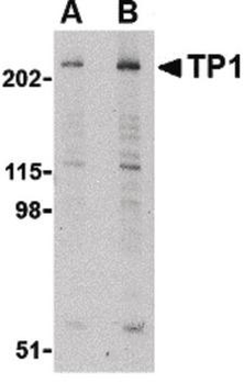 TP1/TEP1 Antibody
