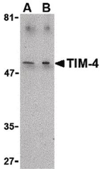 TIMD4/TIM4/TIM-4 Antibody