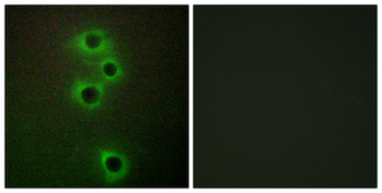 MARK4 Antibody