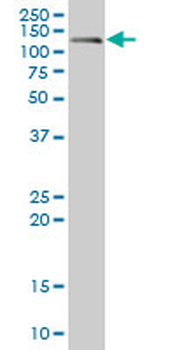 CDH17/Cadherin 17 Antibody