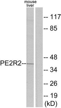 PTGER2/EP2 Antibody