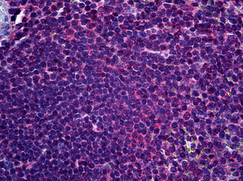 FADS1 Antibody