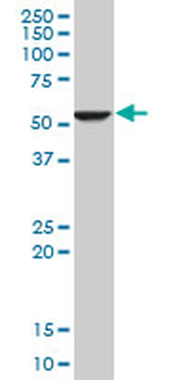 FADS1 Antibody